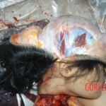 Autopsy of young girl