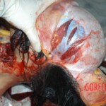 Autopsy of young girl