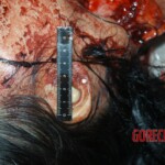 Autopsy of young girl