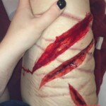 Self-harm girl