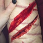 Self-harm girl