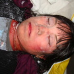 Dead female in morgue