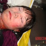 Dead female in morgue