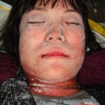 Dead female in morgue