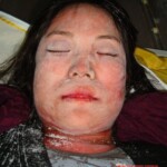 Dead female in morgue