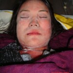 Dead female in morgue