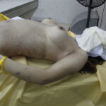 Dead female in morgue