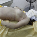 Dead female in morgue