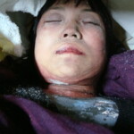 Dead female in morgue