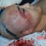 Autopsy of Chinese female