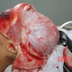 Autopsy of Chinese female