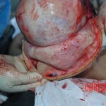 Autopsy of Chinese female