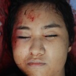 Autopsy of Chinese female