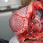 Autopsy of Chinese female