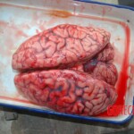 Autopsy of Chinese female