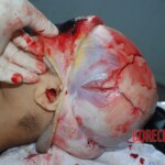 Autopsy of Chinese female