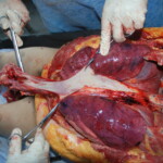 Autopsy of Chinese female