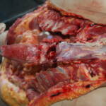Autopsy of Chinese female