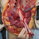 Autopsy of Chinese female