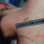 Autopsy of Chinese female