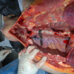 Autopsy of Chinese female