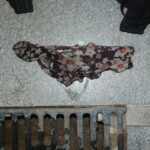 Autopsy of Chinese female