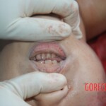 Autopsy of Chinese female