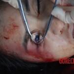 Autopsy of Chinese female