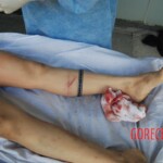 Autopsy of Chinese female