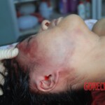 Autopsy of Chinese female