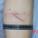 Autopsy of Chinese female