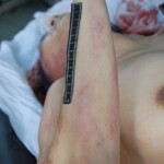 Autopsy of Chinese female