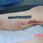 Autopsy of Chinese female