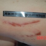 Autopsy of Chinese female