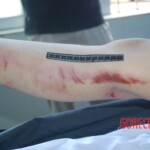 Autopsy of Chinese female