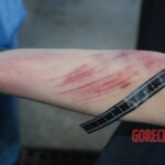 Autopsy of Chinese female