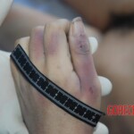 Autopsy of Chinese female