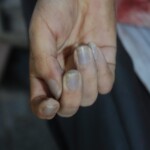 Autopsy of Chinese female