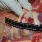 Autopsy of Chinese female