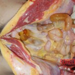 Autopsy of Chinese female