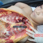 Autopsy of Chinese female