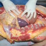 Autopsy of Chinese female