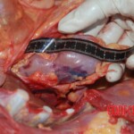 Autopsy of Chinese female