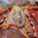 Autopsy of Chinese female