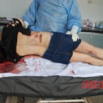 Autopsy of Chinese female