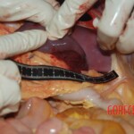 Autopsy of Chinese female