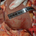 Autopsy of Chinese female