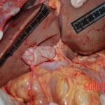 Autopsy of Chinese female