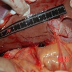 Autopsy of Chinese female