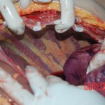 Autopsy of Chinese female